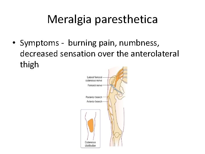 Meralgia paresthetica • Symptoms - burning pain, numbness, decreased sensation over the anterolateral thigh Meralgia paresthetica • Symptoms - burning pain, numbness, decreased sensation over the anterolateral thigh