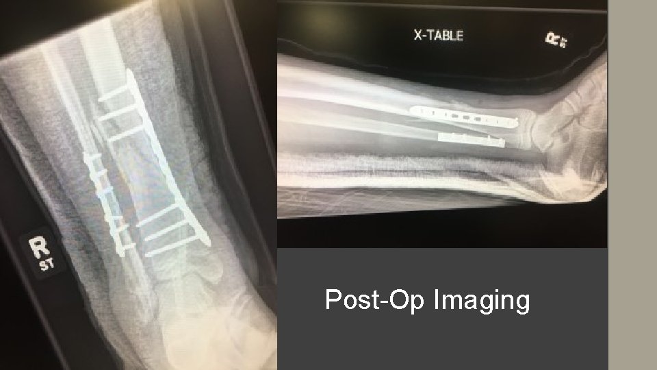 Post-Op Imaging 