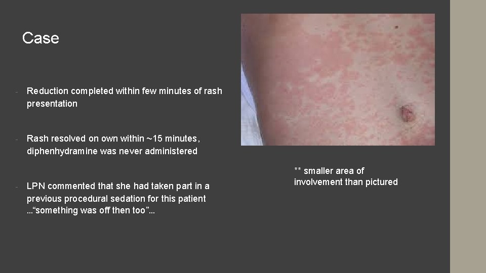 Case - Reduction completed within few minutes of rash presentation - Rash resolved on