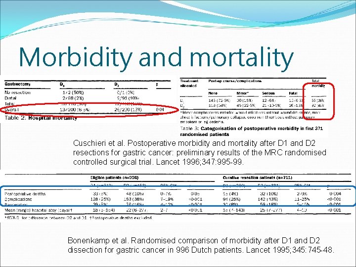 Morbidity and mortality Cuschieri et al. Postoperative morbidity and mortality after D 1 and