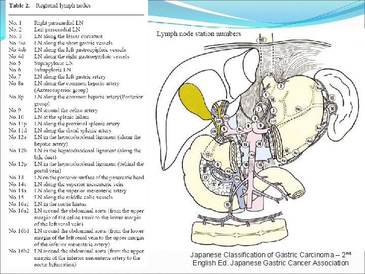 Japanese Classification of Gastric Carcinoma – 2 nd English Ed. Japanese Gastric Cancer Association