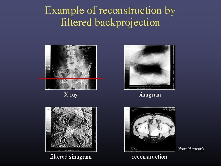 Example of reconstruction by filtered backprojection X-ray sinugram (from Herman) filtered sinugram reconstruction Example of reconstruction by filtered backprojection X-ray sinugram (from Herman) filtered sinugram reconstruction