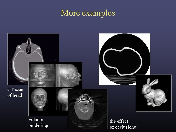 More examples CT scan of head volume renderings the effect of occlusions More examples CT scan of head volume renderings the effect of occlusions