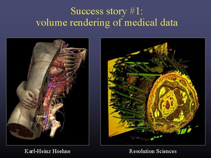 Success story #1: volume rendering of medical data Karl-Heinz Hoehne Resolution Sciences Success story #1: volume rendering of medical data Karl-Heinz Hoehne Resolution Sciences