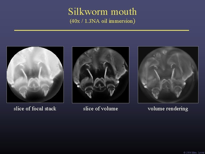 Silkworm mouth (40 x / 1. 3 NA oil immersion) slice of focal stack Silkworm mouth (40 x / 1. 3 NA oil immersion) slice of focal stack