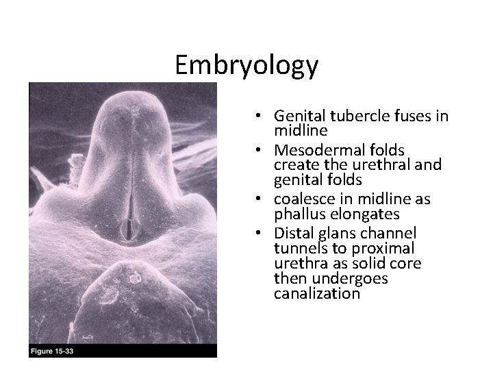 Embryology • Genital tubercle fuses in midline • Mesodermal folds create the urethral and