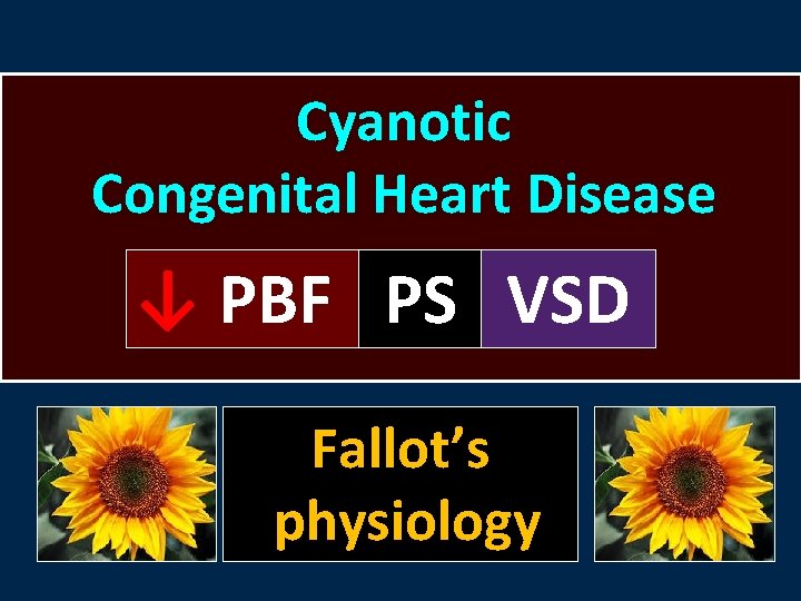 Cyanotic Congenital Heart Disease ↓ PBF PS VSD Fallot’s physiology 