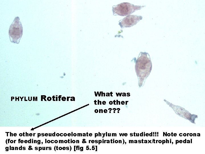 PHYLUM Rotifera What was the other one? ? ? The other pseudocoelomate phylum we