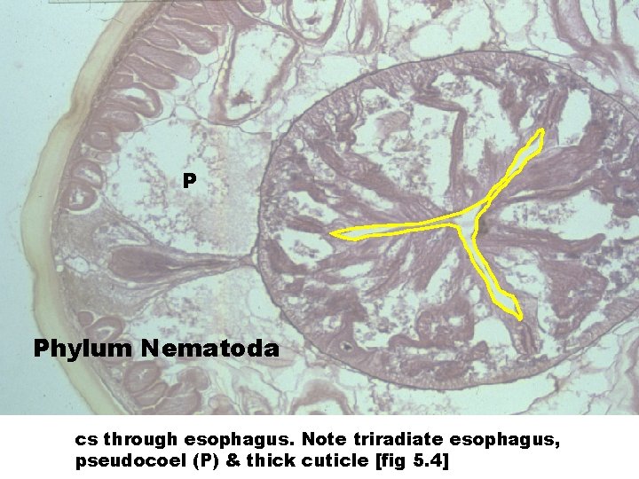 P Phylum Nematoda cs through esophagus. Note triradiate esophagus, pseudocoel (P) & thick cuticle