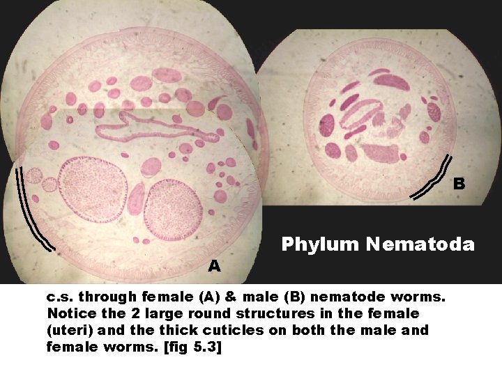 B A Phylum Nematoda c. s. through female (A) & male (B) nematode worms.