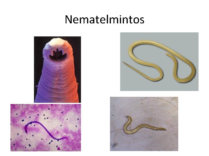 Nematelmintos 