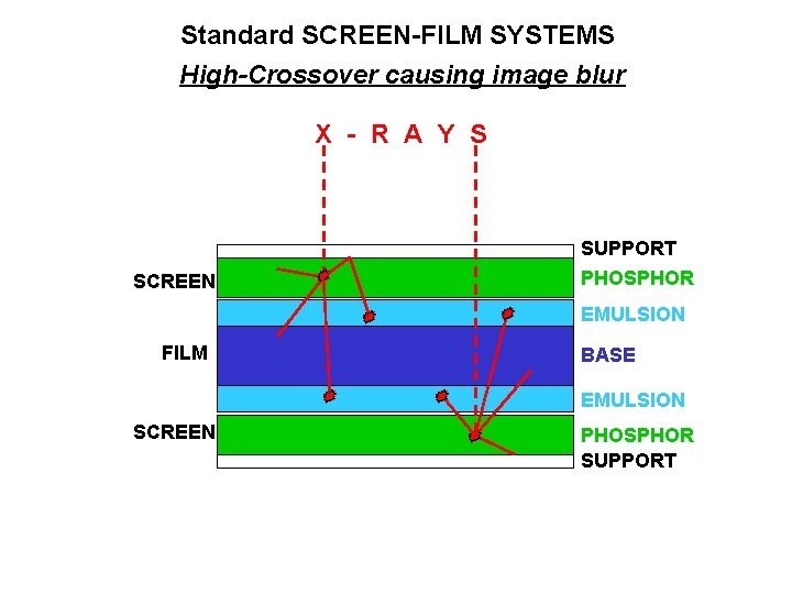 Standard SCREEN-FILM SYSTEMS High-Crossover causing image blur X - R A Y S SCREEN