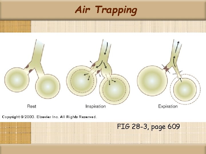 Air Trapping FIG 28 -3, page 609 
