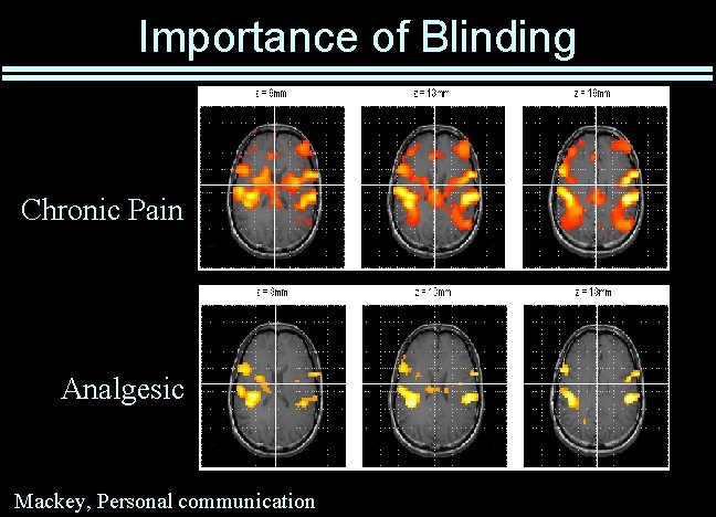 Importance of Blinding Chronic Pain Analgesic Mackey, Personal communication 