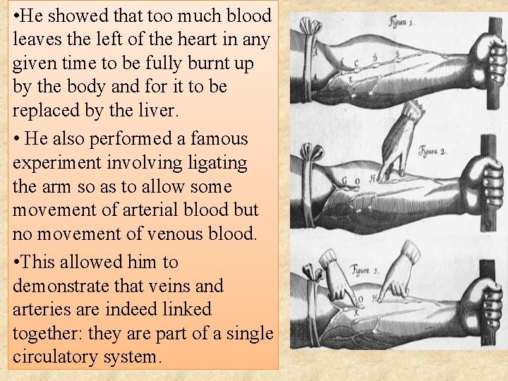  • He showed that too much blood leaves the left of the heart
