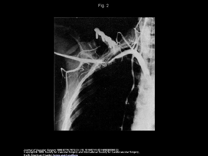 Fig. 2 Journal of Vascular Surgery 1989 9778 -787 DOI: (10. 1016/0741 -5214(89)90085 -2)