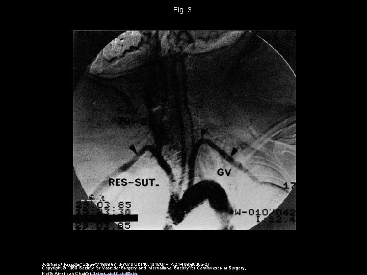 Fig. 3 Journal of Vascular Surgery 1989 9778 -787 DOI: (10. 1016/0741 -5214(89)90085 -2)