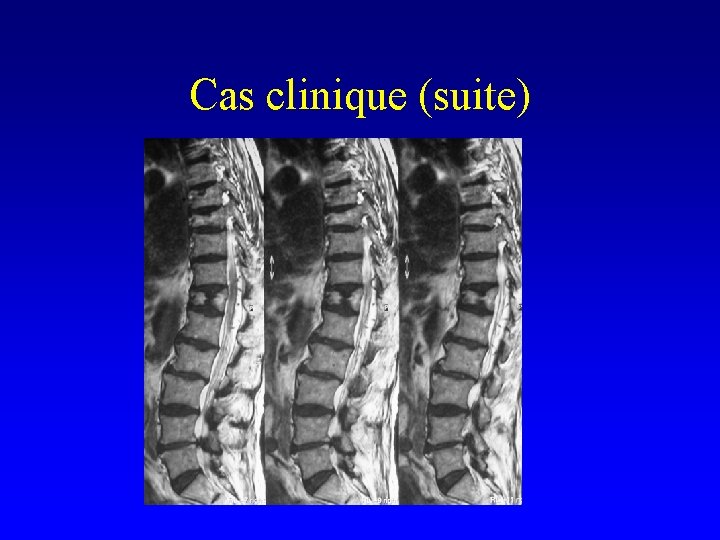 Cas clinique (suite) 