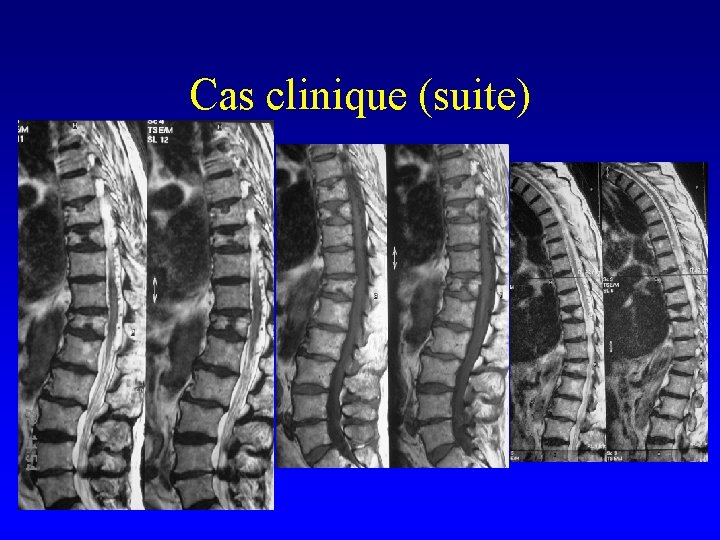 Cas clinique (suite) 