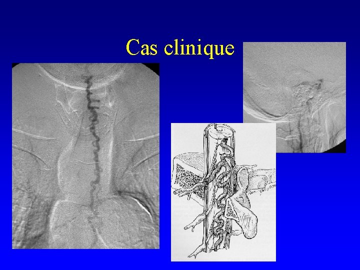 Cas clinique 