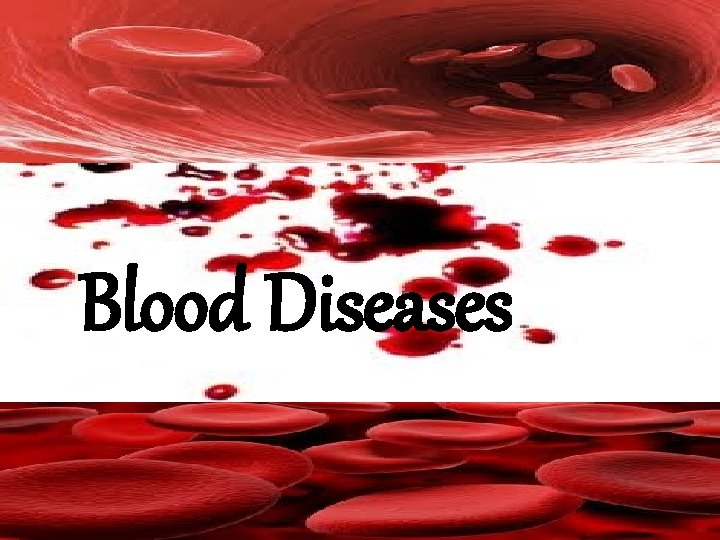 Blood Diseases Blood Diseases