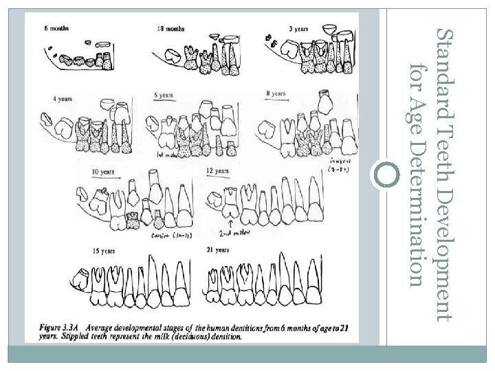 Standard Teeth Development for Age Determination 