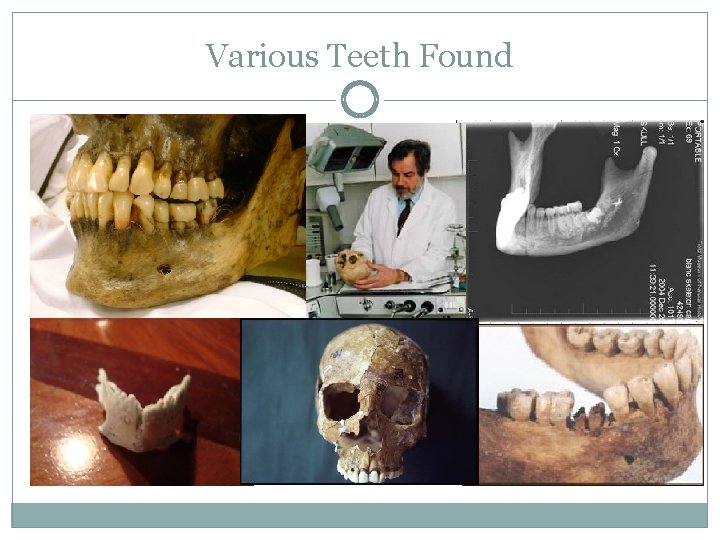 Various Teeth Found 