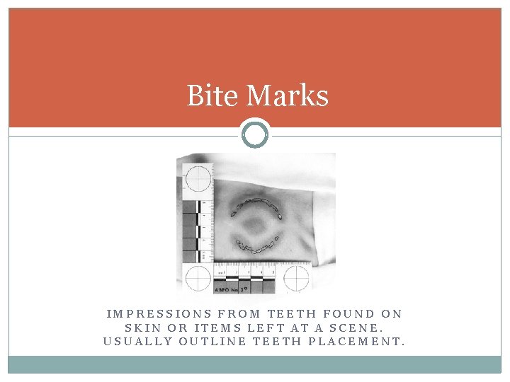 Bite Marks IMPRESSIONS FROM TEETH FOUND ON SKIN OR ITEMS LEFT AT A SCENE.