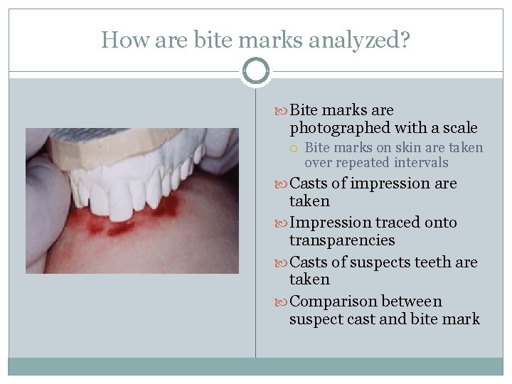 How are bite marks analyzed? Bite marks are photographed with a scale Bite marks