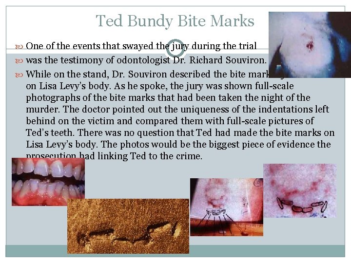 Ted Bundy Bite Marks One of the events that swayed the jury during the