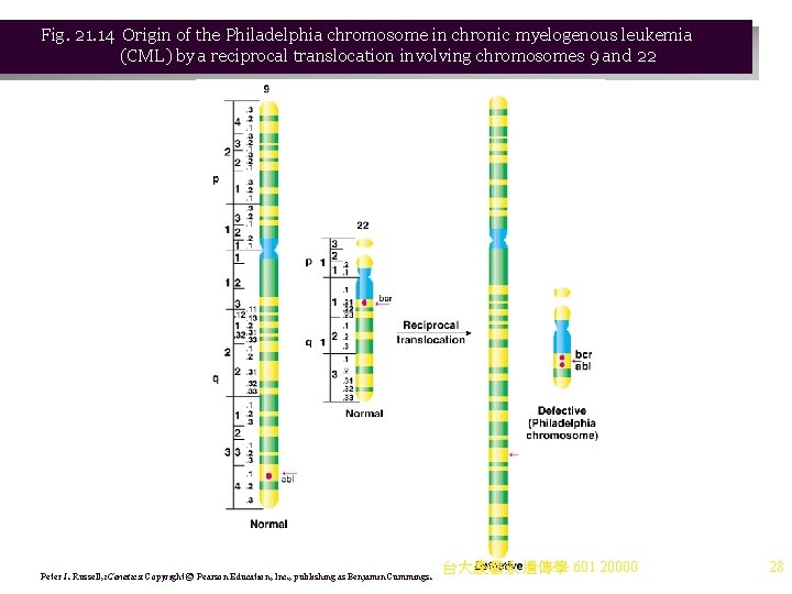 Fig. 21. 14 Origin of the Philadelphia chromosome in chronic myelogenous leukemia (CML) by