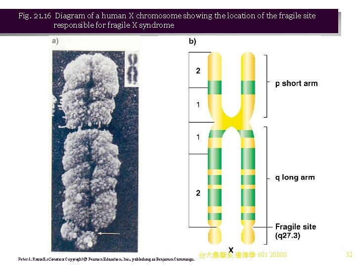Fig. 21. 16 Diagram of a human X chromosome showing the location of the