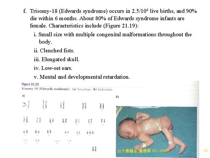f. Trisomy-18 (Edwards syndrome) occurs in 2. 5/104 live births, and 90% die within