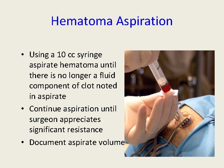 Hematoma Aspiration • Using a 10 cc syringe aspirate hematoma until there is no