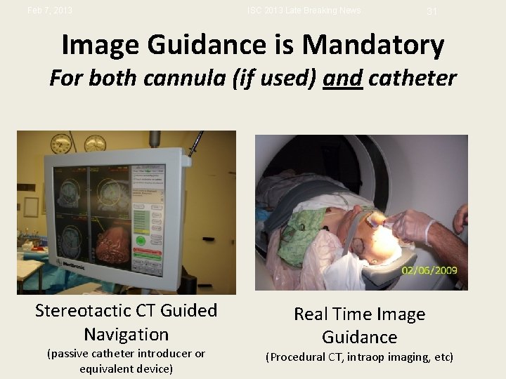 Feb 7, 2013 ISC 2013 Late Breaking News 31 Image Guidance is Mandatory For