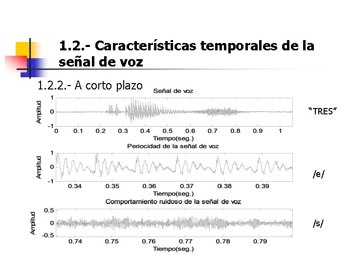 1. 2. - Características temporales de la señal de voz 1. 2. 2. - 1. 2. - Características temporales de la señal de voz 1. 2. 2. -