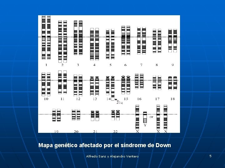 Mapa genético afectado por el síndrome de Down Alfredo Sanz y Alejandro Ventero 5