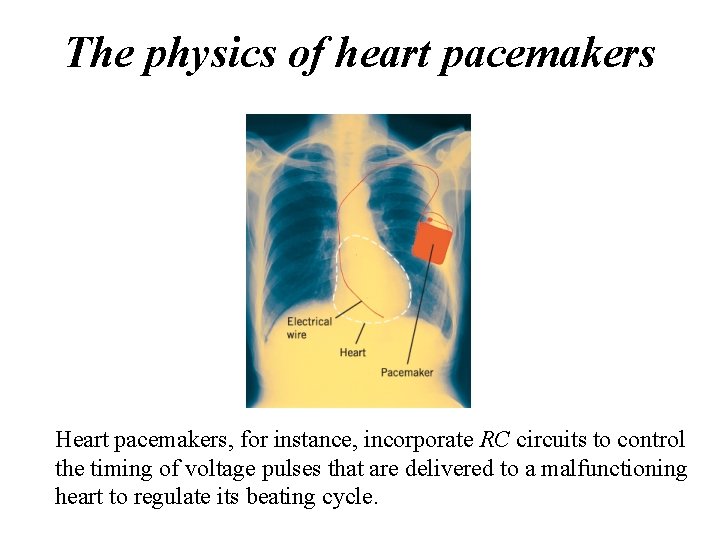 The physics of heart pacemakers Heart pacemakers, for instance, incorporate RC circuits to control