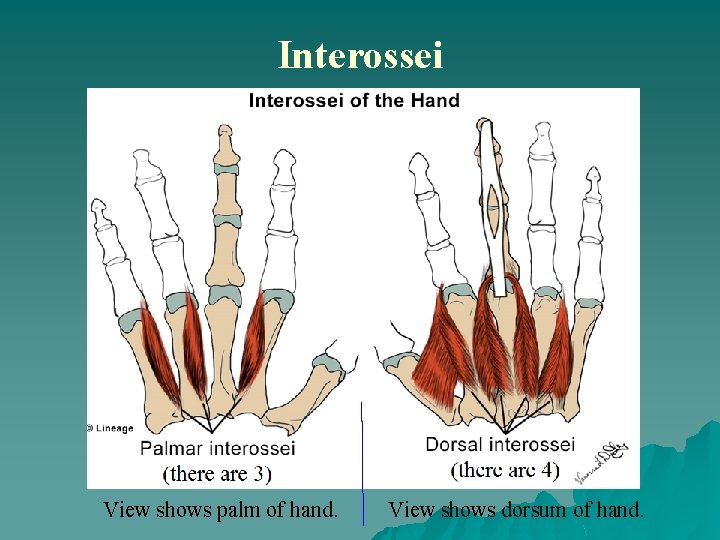 Interossei View shows palm of hand. View shows dorsum of hand. 