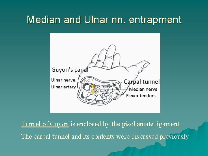 Median and Ulnar nn. entrapment Tunnel of Guyon is enclosed by the pisohamate ligament