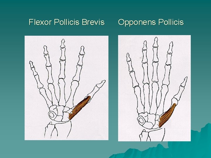 Flexor Pollicis Brevis Opponens Pollicis 