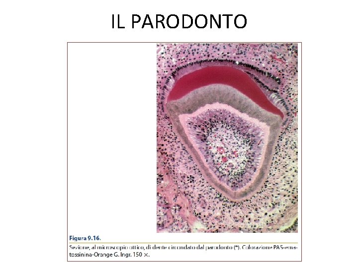 IL PARODONTO 