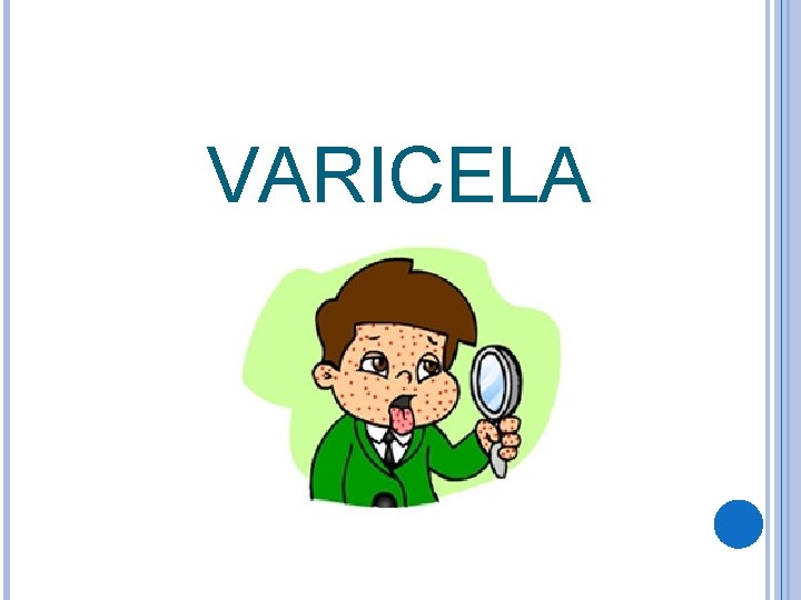 VARICELA 