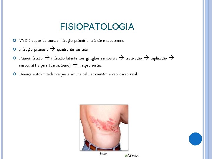 FISIOPATOLOGIA VVZ é capaz de causar infecção primária, latente e recorrente. Infecção primária quadro