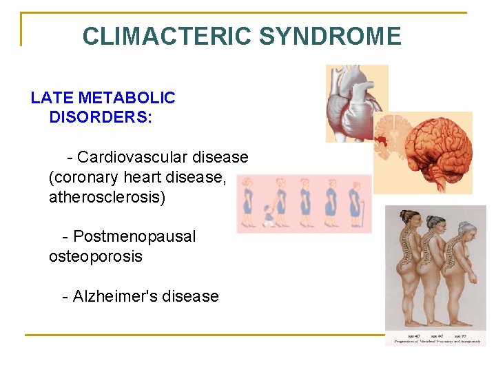 CLIMACTERIC SYNDROME LATE METABOLIC DISORDERS: - Cardiovascular disease (coronary heart disease, atherosclerosis) - Postmenopausal