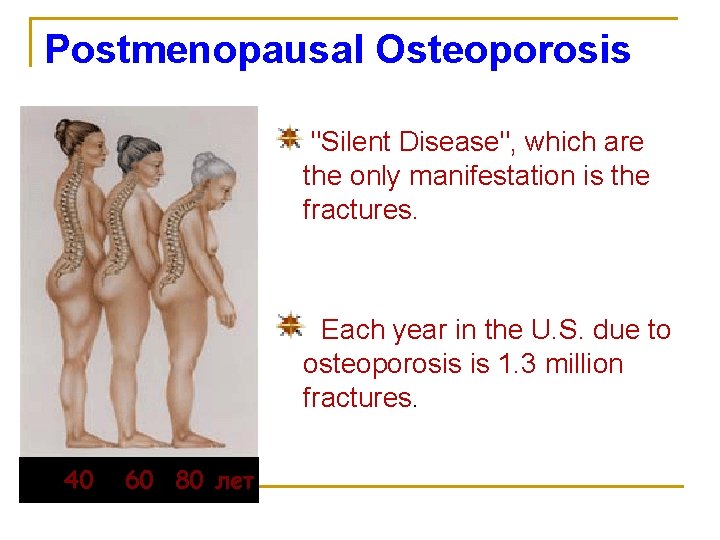 Postmenopausal Osteoporosis "Silent Disease", which are the only manifestation is the fractures. Each year