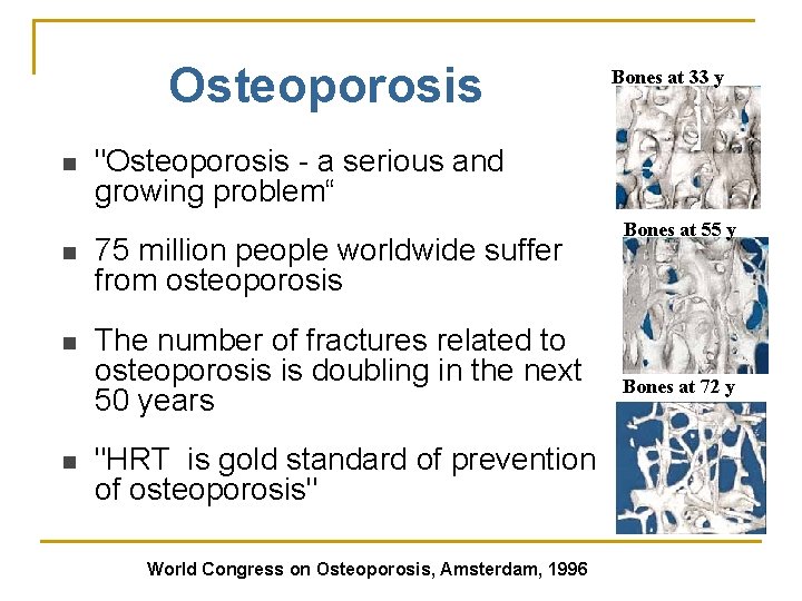 Osteoporosis n "Osteoporosis - a serious and growing problem“ n 75 million people worldwide