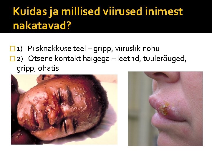 Kuidas ja millised viirused inimest nakatavad? � 1) � 2) Piisknakkuse teel – gripp,