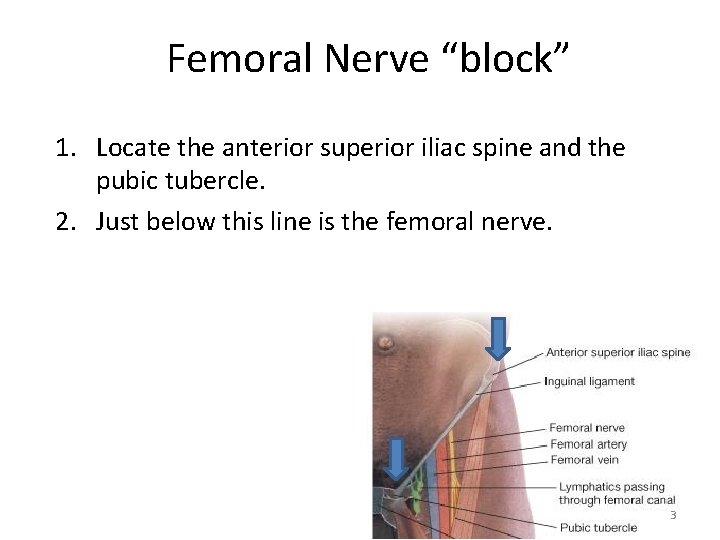 Femoral Nerve “block” 1. Locate the anterior superior iliac spine and the pubic tubercle. Femoral Nerve “block” 1. Locate the anterior superior iliac spine and the pubic tubercle.
