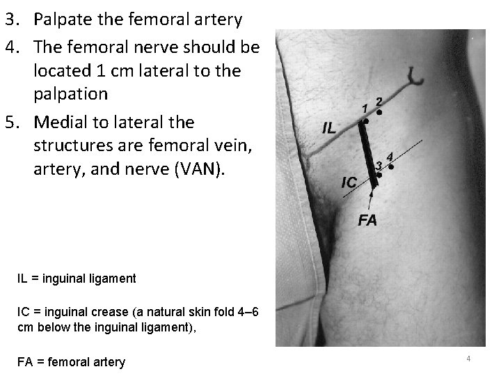 3. Palpate the femoral artery 4. The femoral nerve should be located 1 cm